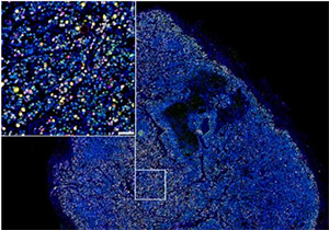Calcium Sensing Receptor