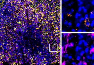 Immune Checkpoint