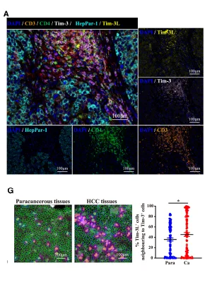 Spatial and functional analysis of Tim3/Tim3-Ligands in tumor development