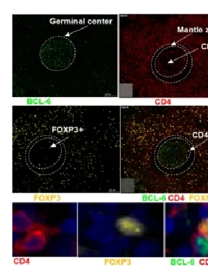 Impact of HIV on T Follicular Regulatory Cells in Human Lymph Nodes