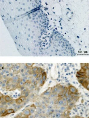 Erk1/2-Dependent HNSCC Cell Susceptibility to Erastin-Induced Ferroptosis