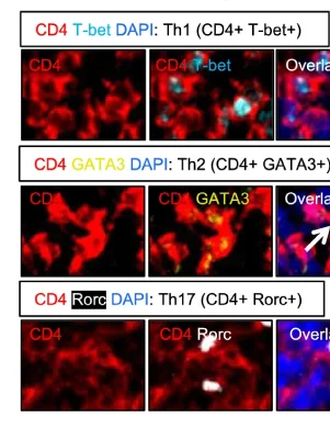 Cytotoxic CD8+ T cells may be drivers of tissue destruction in Sjögren’s syndrome