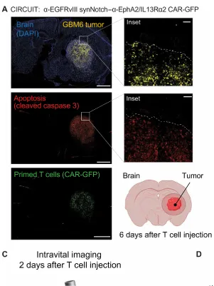 SynNotch-CAR T cells overcome challenges in treating glioblastoma