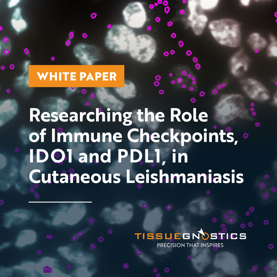 Tumor Microenvironment