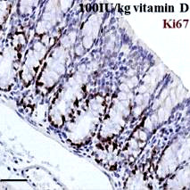 Anti-Neoplastic Effects of Calcium