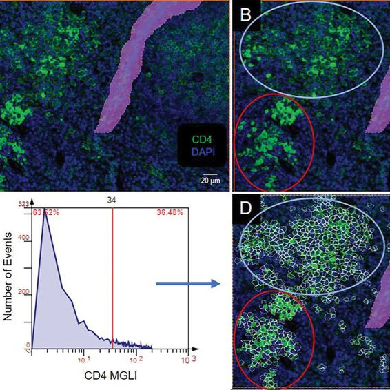 Anti-Neoplastic Effects of Calcium