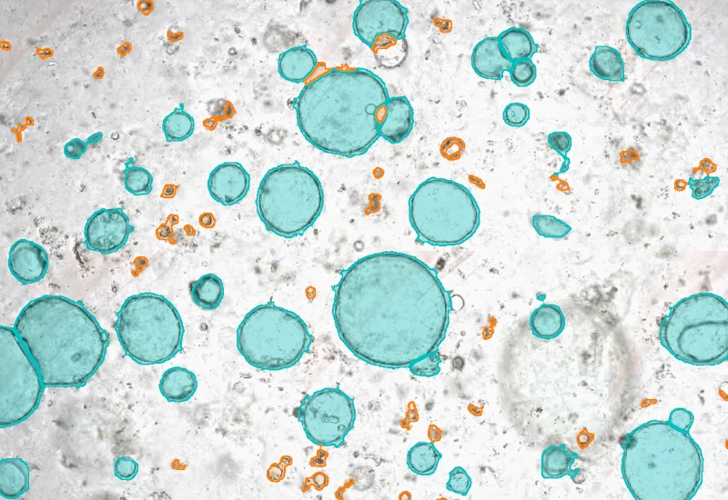 Analysis of Organoid and Immune Cell Co-Cultures By Machine Learning ...