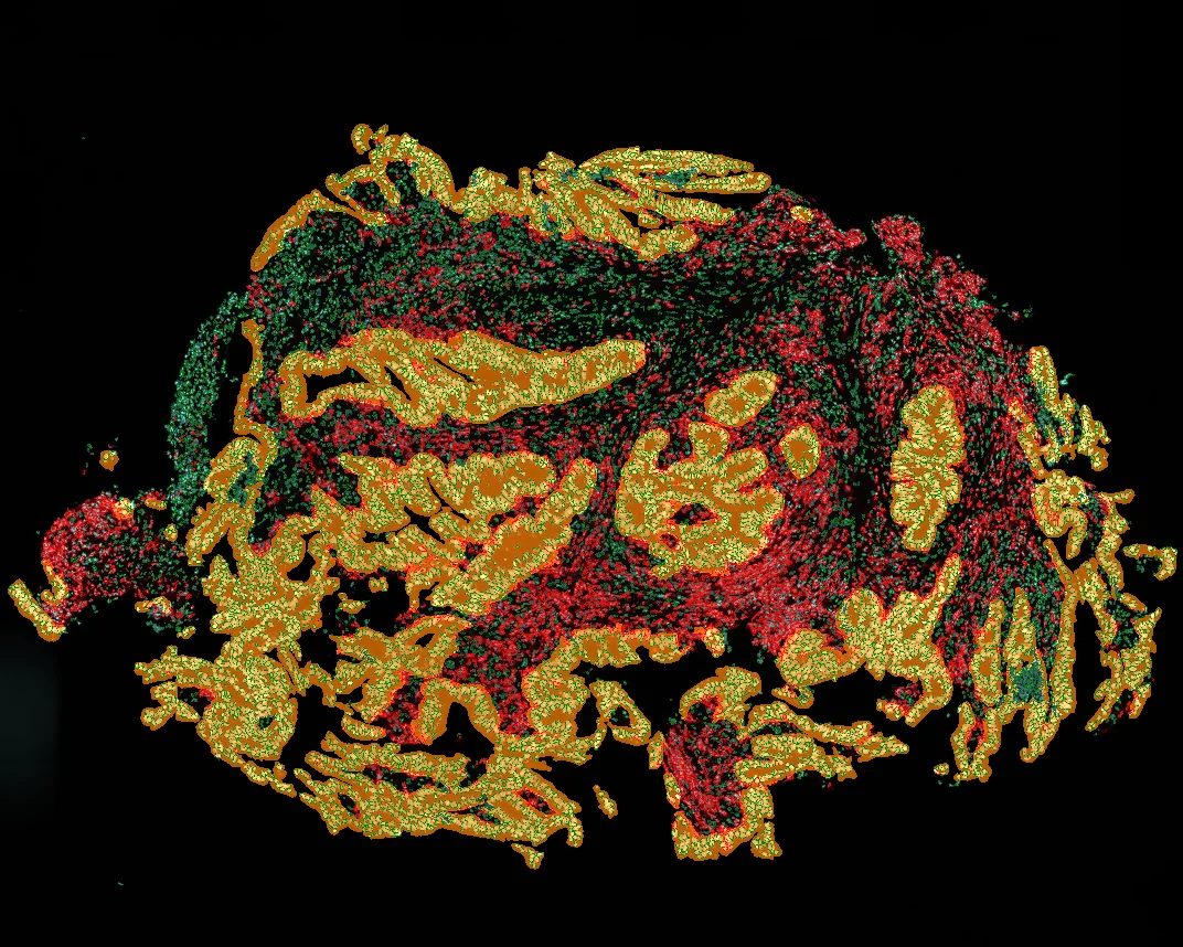 Dynamic Content Image