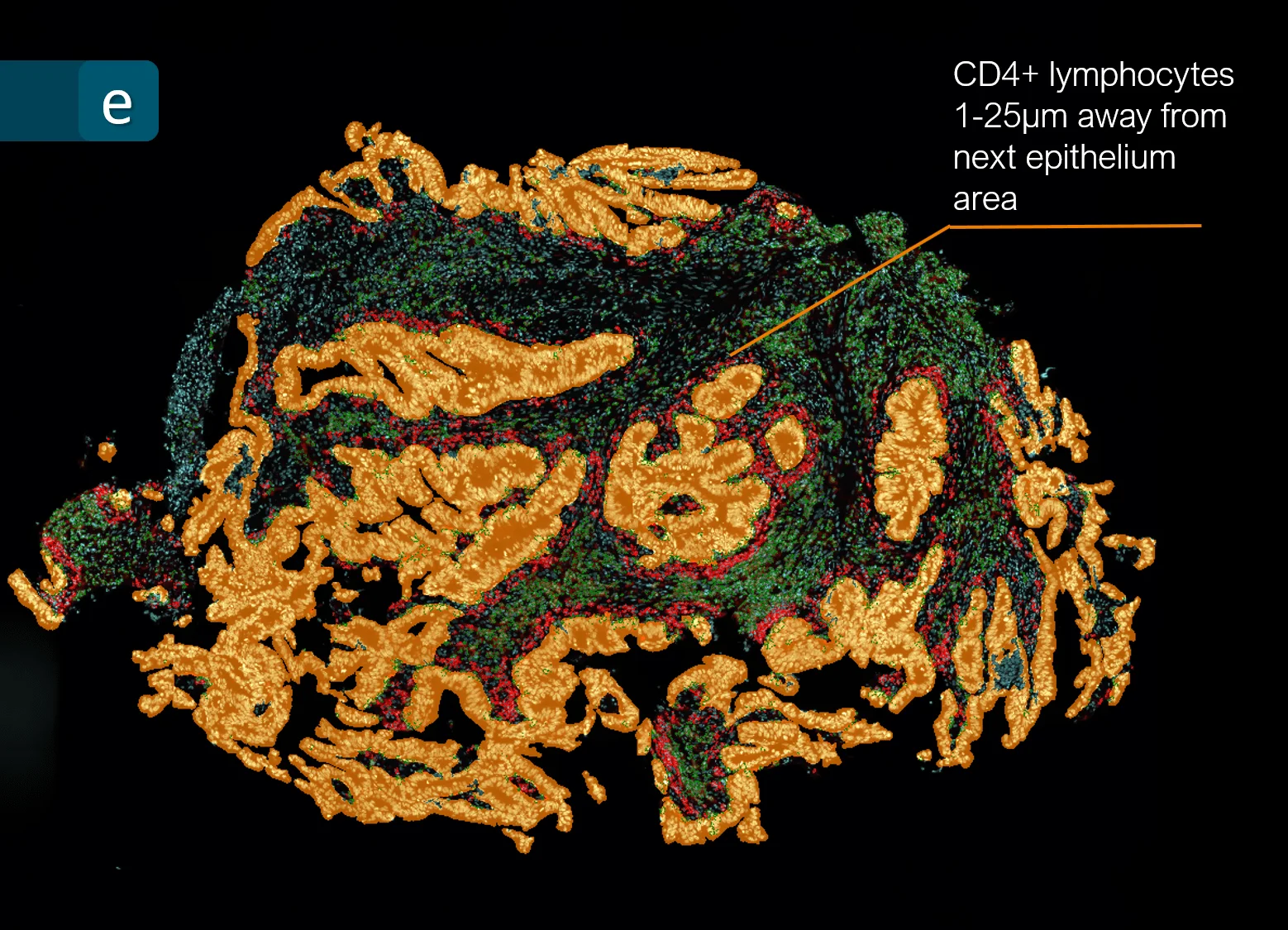 CRC CD4 25&micro;m v1 min