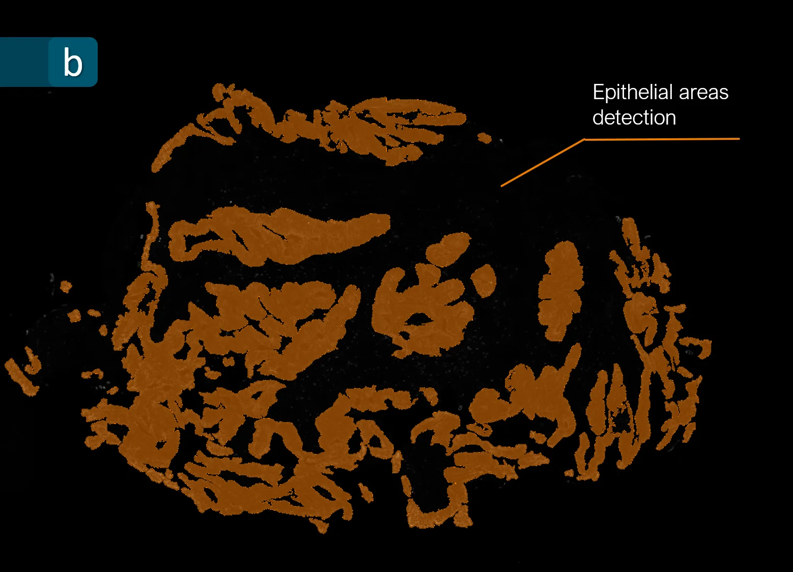 CRC epithelial v1 min