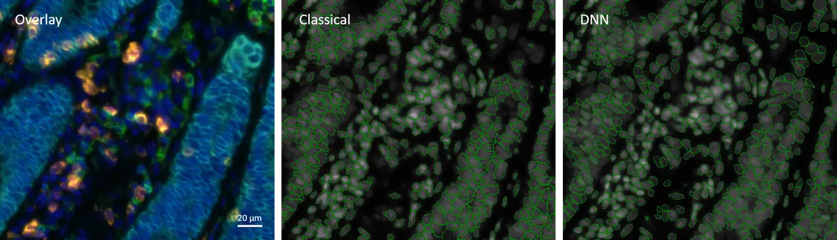 Classical vs DNN segmentation min