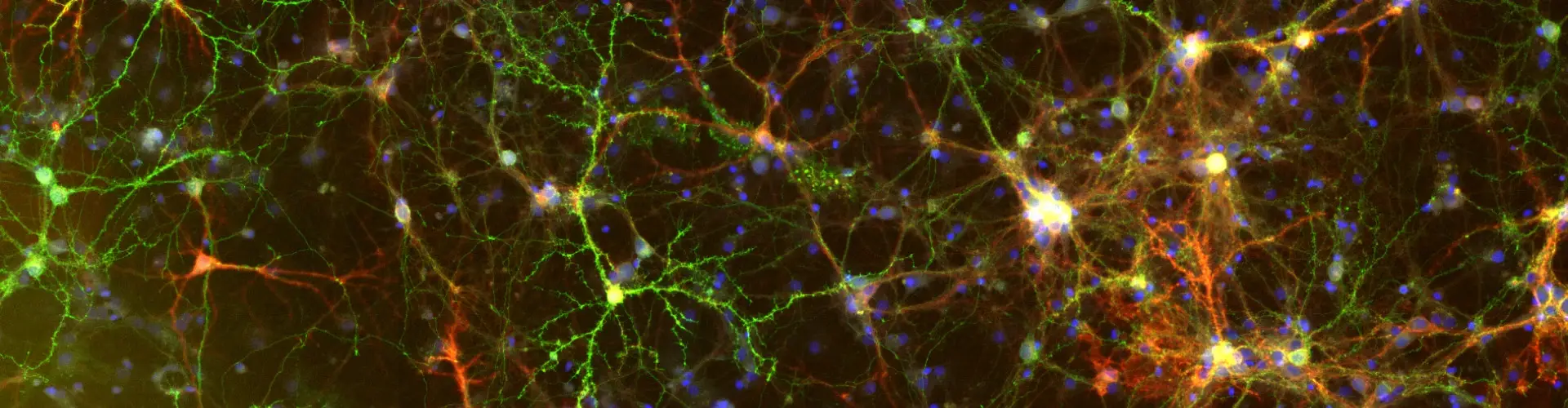immunofluorescent neuron image. The text reads TissueFAXS Viewer, Free Viewer Software 