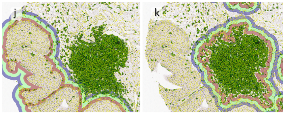 TissueClassification2 cut