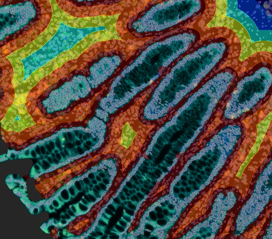 Color-coded tissue map showing phenotype distribution by proximity to colon crypts, with layered distance zones and segmentation.