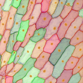 EBER ISH EBER ISHcells 274x274