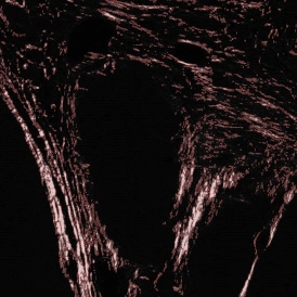 EBER ISH EBER ISHcells 274x274