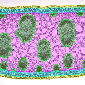 EBER ISH EBER ISHcells 274x274